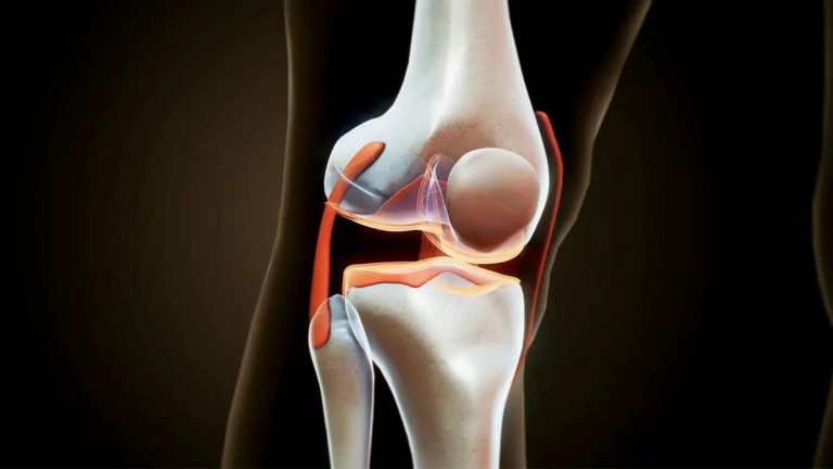 AI Blood Test Could Detect Knee Osteoarthritis 8 Years Earlier than X-ray